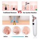 Face Vacuum Suction Blackhead Remover Pore Cleaner | Electric Deep Cleansing Tool for Nose & Face